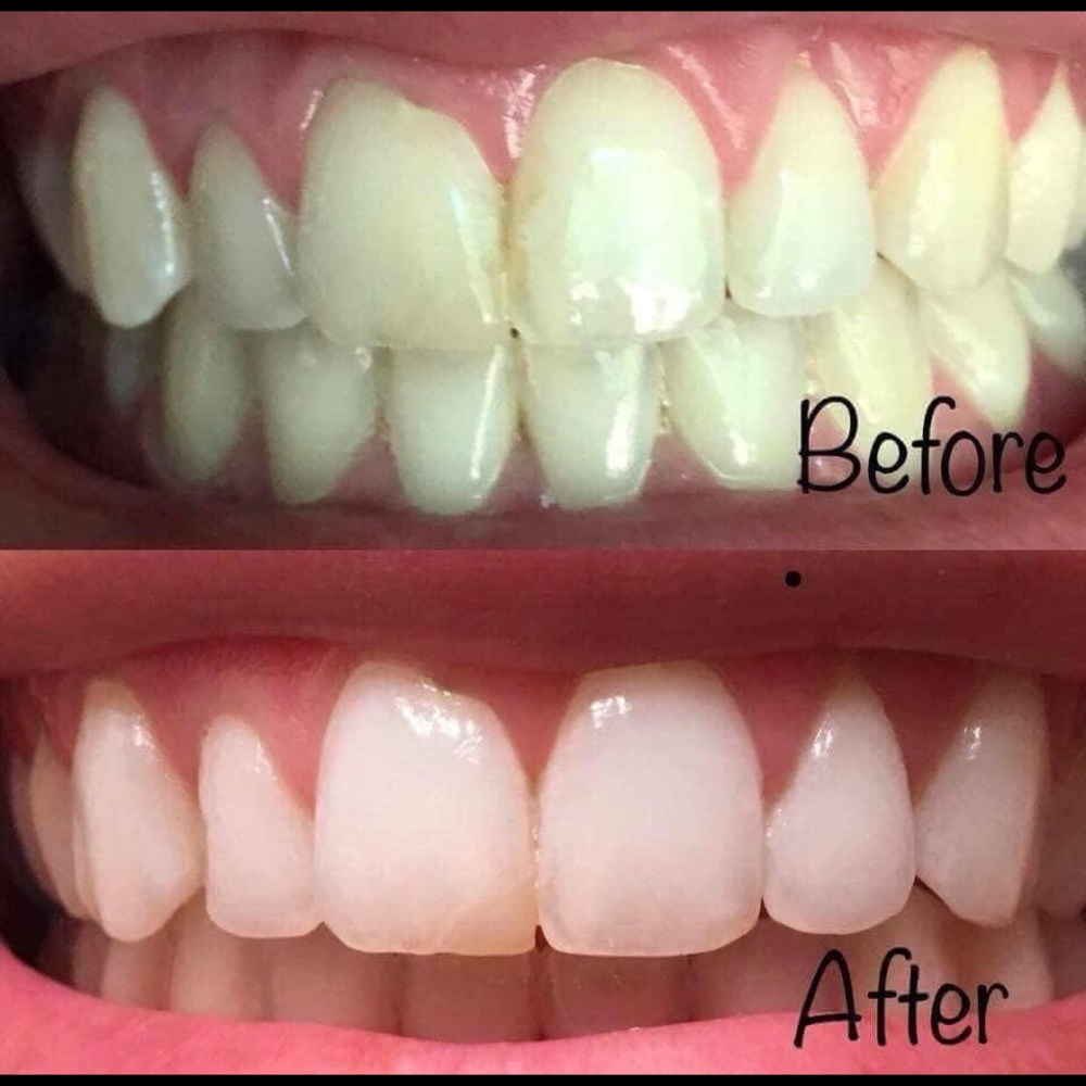 Toothpaste - Picture 5 of 6